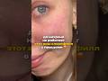 Как же Я УСТАЛА😱Мой путь к чистой коже💔 арт. #WW387902 (копируй и вставляй на WB)