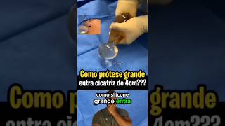 Cirurgião Revela Segredo Cirurgia Prótese Silicone