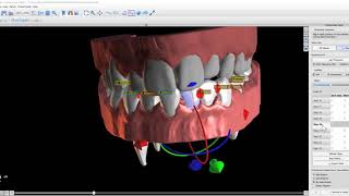 BSP 4.7 Ortho - Step Creation