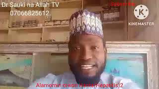 Alamomin Ciwon Hanta Hepais