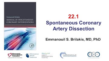 22 1 SCAD: Manual of PCI