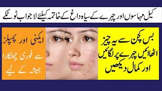 Best Home Remedies to Get Rid of Acne Pimples, Dark Spots/Desi nuskhey for pimples on face/AL SHAFI