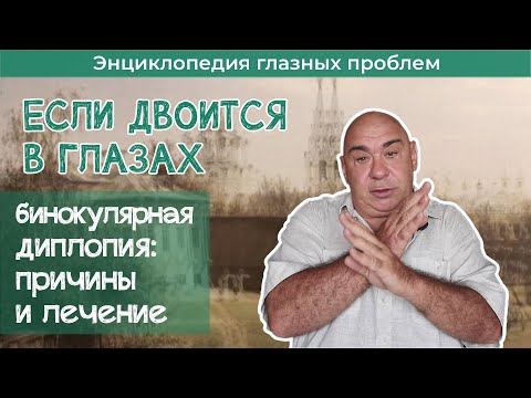 Почему двоится в глазах  Бинокулярная диплопия