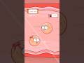 👶كيف يتشكل التوائم غير المتماثلة؟❓#shorts#funny#hot