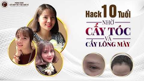 [LỘT XÁC] Thay đổi diện mạo nhờ cấy tóc và cấy lông mày tự thân | Trung tâm Cấy tóc Y học Quốc tế