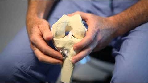 Anatomic ACL Reconstruction