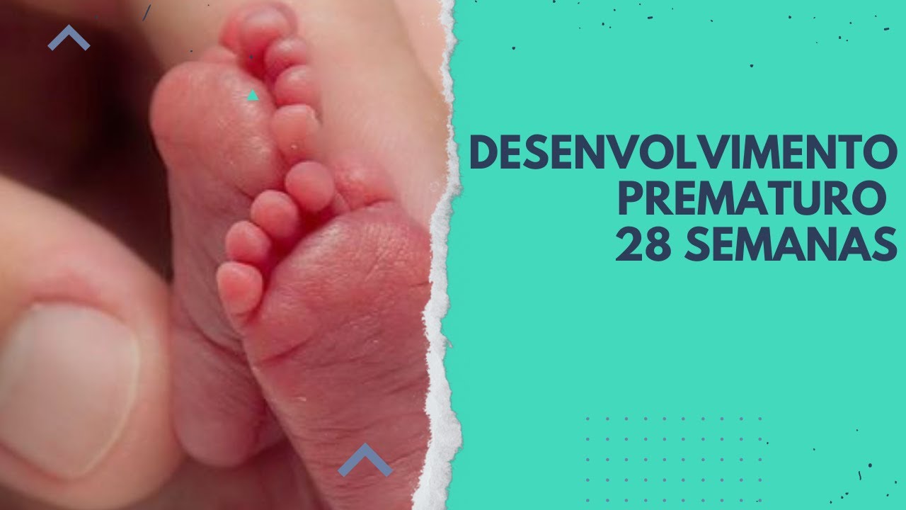 Como é o desenvolvimento motor do bebê prematuro de 28 semanas de ...