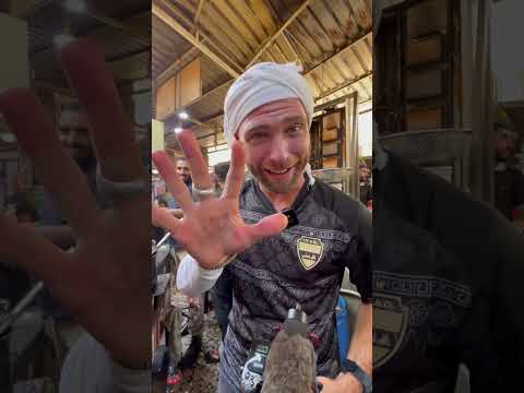 🇮🇶 1st Degree Falafel Burns in Baghdad Iraq #shorts