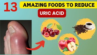 Say Goodbye to Gout: 13 Foods That Reduce Uric Acid!