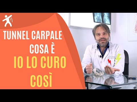 Video: Intorpidimento Del Polso: Tunnel Carpale, Artrite E Trattamento