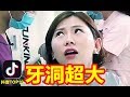 【抖音】小姐姐你牙洞超大  牙醫說是他這輩子見過最大的 最大的……