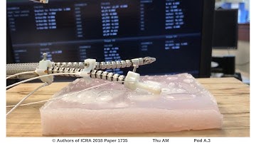 Trajectory-Optimized Sensing for Active Search of Tissue Abnormalities in Robotic Surgery
