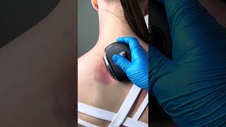 Myofascial Shoulder Pain Relief: How I Finally Released That Deep Knot 🧠💆♀️