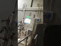 Dialysis is blessing for kidney patient #kidney#dialysis#ckdlife#dilaysislife