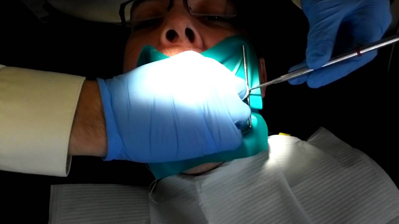 A Root Canal YouTube