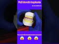 Full Mouth Implants #dentist#DRIshratMafruha #Denta #shorts #funny #machine #dental
