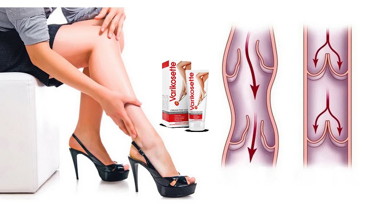 Varikosette Para Que Sirve