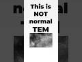 This Is NOT a Normal TEM Image
