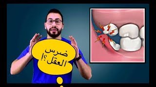 📛ضرس العقل و مشاكله و طرق علاجه و كيفية خلعه , ولماذا سمي بهذا الاسم ؟، انتبه لهذه المعلومات المهمه