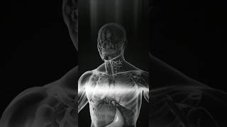 История изменившая медецину:Рентген! #ИсторияРентгена #Медицина #НаучныеОткрытия