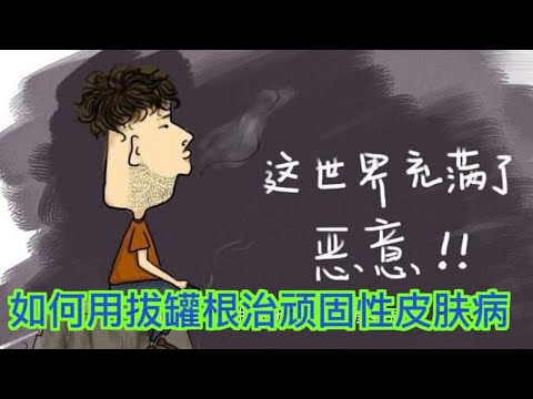 如何用拔罐根治顽固性皮肤病#荨麻疹 #带状疱疹