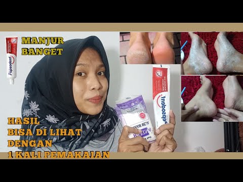 Video: 3 Cara Merawat Kaki yang Kasar dan Kering