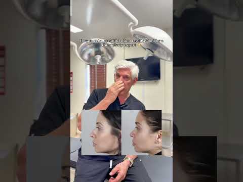 Video thumbnail: The rhinoplasty expert 💖 #rhinoplasty #before andafter e · Paul Parker, M.D.