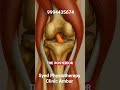 Real difference between ACL,MCL and PCL #fyp #acl #pcl #mcl ✅Syed Physiotherapy Clinic ambur 🔥