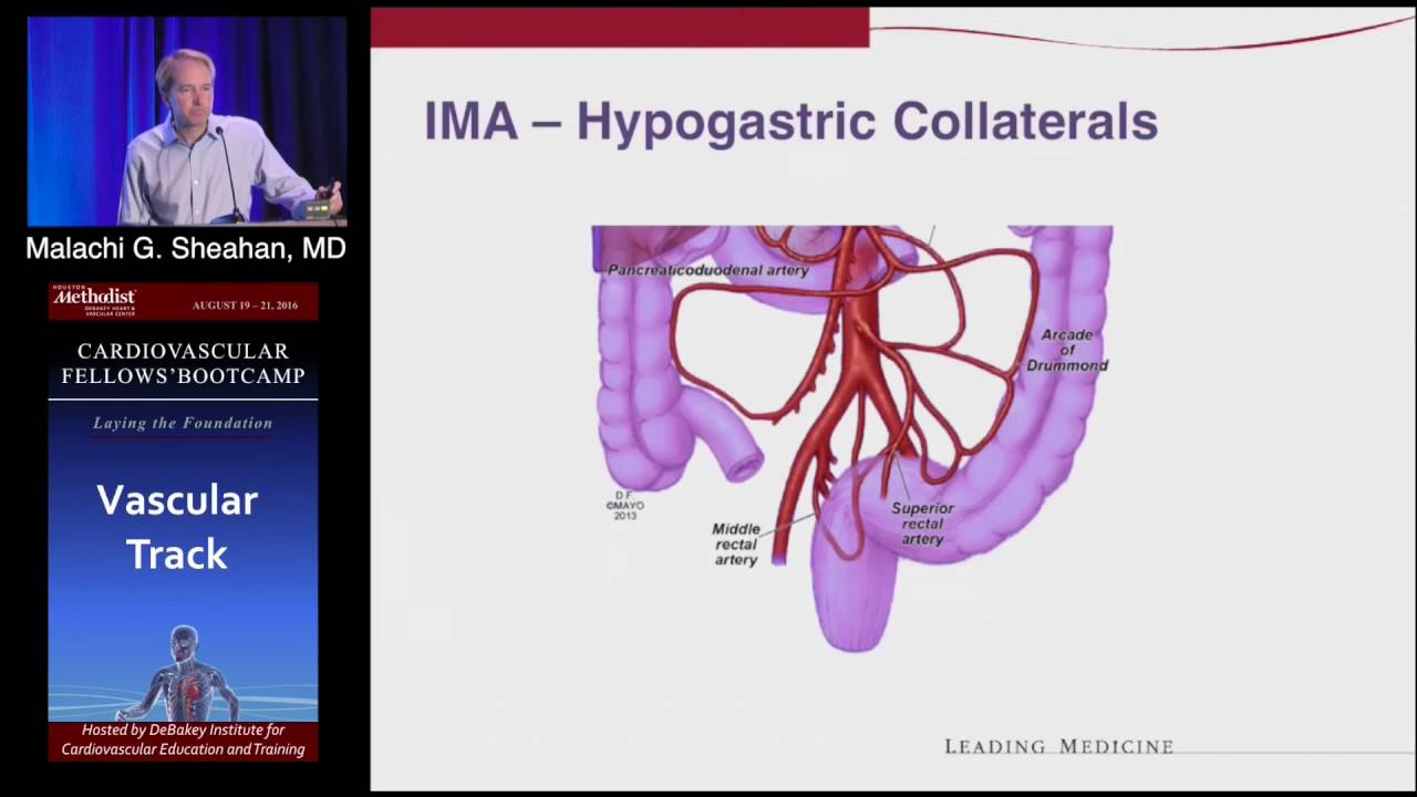 Anatomy and Physiology/Diagnosis and Imaging of Visceral Artery Disease linda lederer