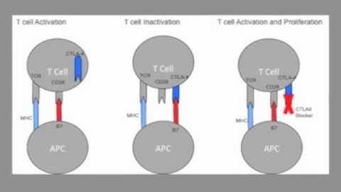 Video Abstract: Immune Checkpoint Inhibitor Therapy Associated Hypophysitis