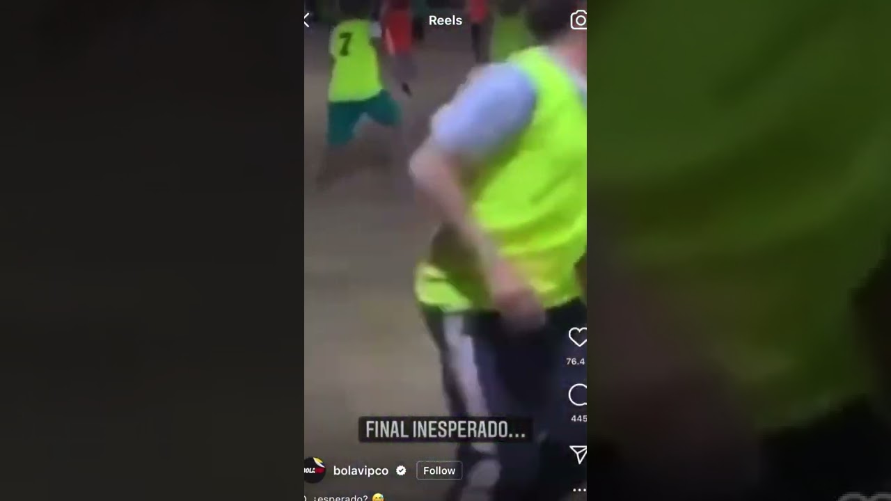 He broke his arm after playing football 🤣￼