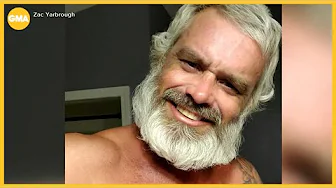 Man shares his journey living with stage 4 male breast cancer