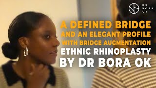 A Defined Bridge and An Elegant Profile with Bridge Augmentation | Ethnic Rhinoplasty by Dr Bora Ok