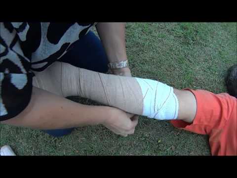 Pressure Immobilization Technique (PIT) Arm Demo  by B- Ready First Aid