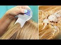 LiCE iN OUR HOUSE? | Tips for Natural Lice Removal & Treatment