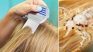 LiCE iN OUR HOUSE | Tips for Natural Lice Removal & Treatment