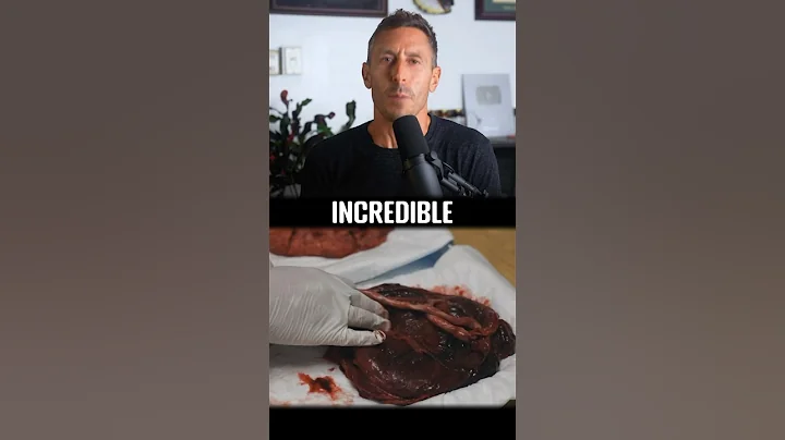 Are vegetarian diets healthy for pregnancy? thumbnail