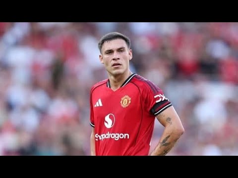 لماذا خي ب مانويل أوغارتي آمال جماهير مانشستر يونايتد