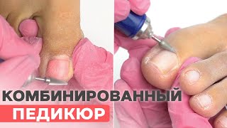 Комбинированный ПЕДИКЮР | Обработка пальцев ног пошагово