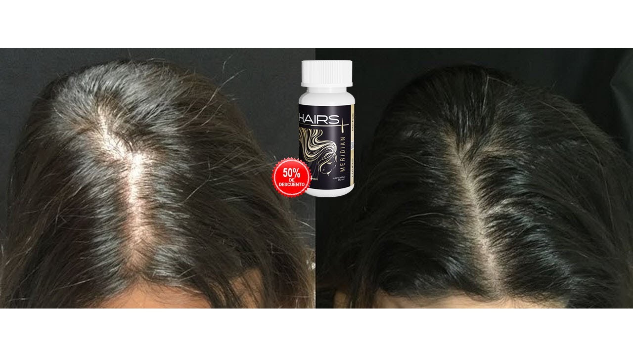 Hairs Meridian Para Q Sirve YouTube