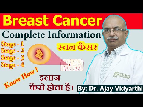 Breast Cancer - स्तन कैंसर | Stage 1 to Stage 4 - Complete Info & Detection | By: Dr. Ajay Vidyarthi