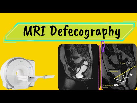 Video MRI Defecography ( Động học sàn chậu tống phân) - youtube