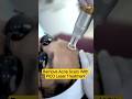 Remove Acne Scars With PICO Laser Treatment | Clear Skin Clinic, Pune