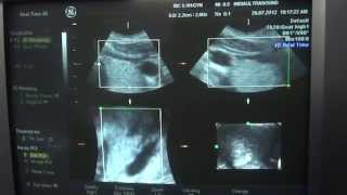 RIC 5 9 4d video
