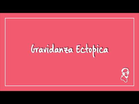 Video: Mestruazioni Con Gravidanza Ectopica