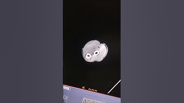 ct artifacts #ctscan #mriscan #radiographer_course #radiologist #radiology