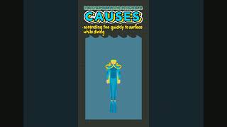 Decompression Sickness Facts! #short