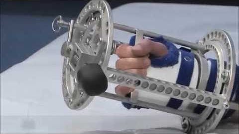 How To Return The Forearm Dynasplint System