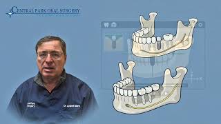 3D CBCT Scan for Dental Implants NYC – How 3D imaging tech improves safety, accuracy, and outcomes