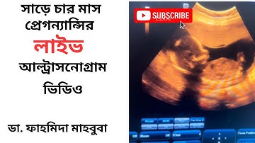 সাড়ে চার মাসের ( ১৮ সপ্তাহ ) গর্ভবতী মায়ের লাইভ আল্ট্রাসনোগ্রাম ভিডিও দেখে নিন